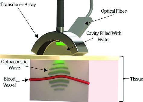 Partial cut-away view of a curved ultrasound transducer array is used ...