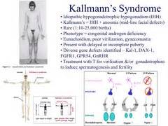 Kallmann syndrome