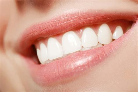 3 Ways Perfect Teeth for Gorgeous Smile- Florida Independent