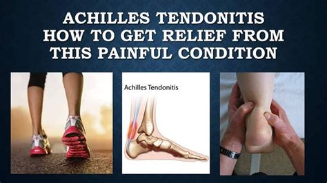 Can Tendonitis Travel Up Your Arm - TRAVELVOS