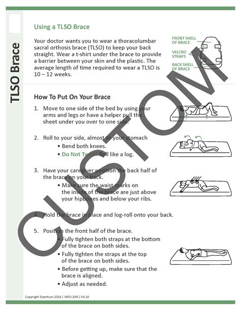Using a TLSO Brace Custom | Eventium