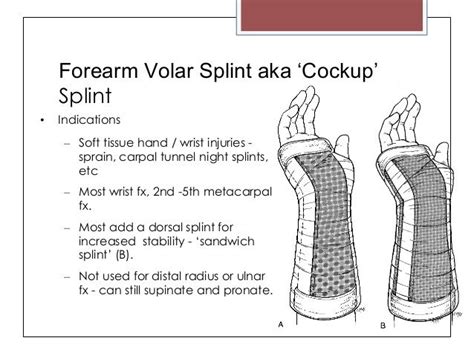 dynamic splint 90 degree angle of pull - Google Search | Occupational therapy, Nbcot exam ...