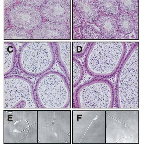 Tissue Histology and Sperm Cytology. Hematoxylin-eosin stained section... | Download Scientific ...