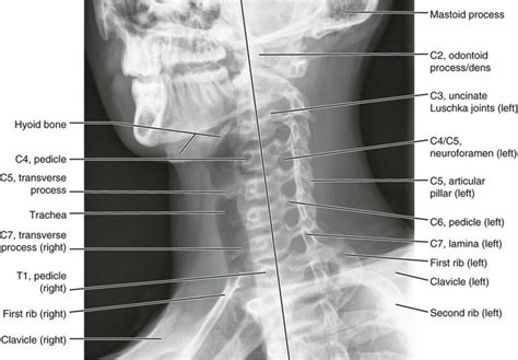 Normal Anatomy | Radiology Key