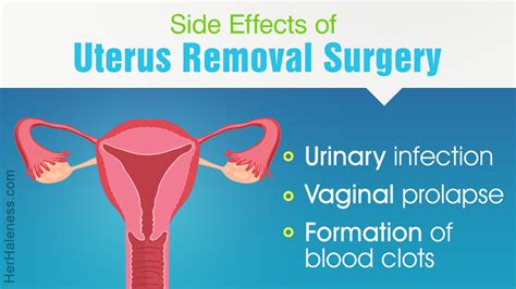 Hysterectomy refers to the surgical removal of the uterus or womb, and may be advised in case of ...