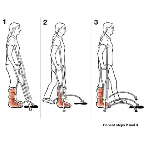 Step-by-Step: Using Crutches with Step Through (Weight Bearing) | Saint ...