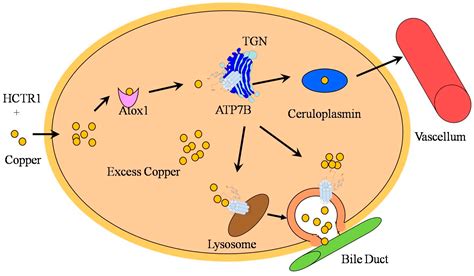 IJMS | Free Full-Text | Wilson’s Disease: A Comprehensive Review of the ...