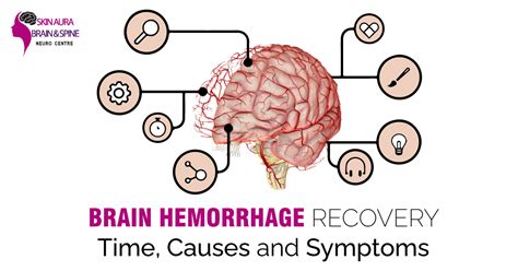 Brain Hemorrhage Recovery Time, Causes, and Symptoms