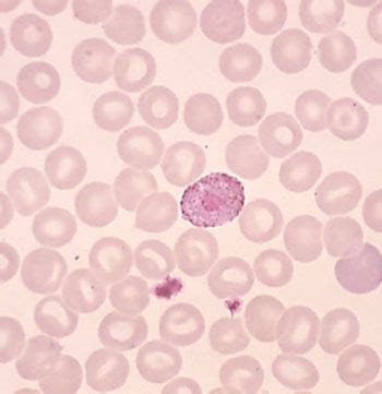 Plasmodium Malariae Gametocyte