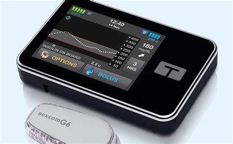 Closed Loop Insulin Pump Systems