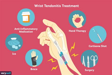 Wrist Tendonitis: Symptoms, Causes, Diagnosis, Treatment