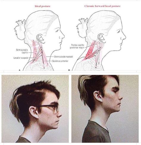 What does Posture have to do with Breathing?