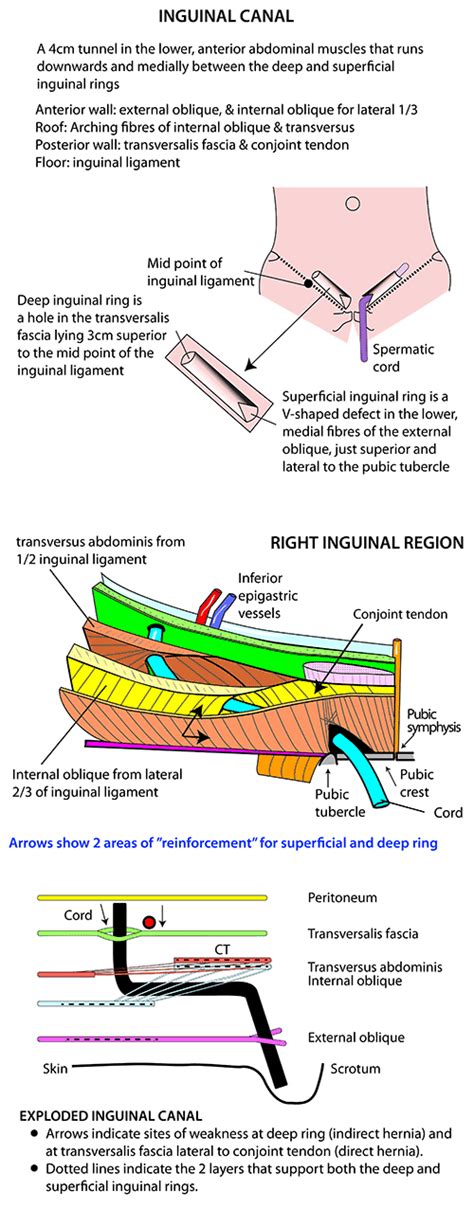 Instant Anatomy - Abdomen - Areas/Organs - Inguinal region - Inguinal canal