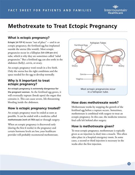 Methotrexate to Treat Ectopic Pregnancy Fact Sheet - DocsLib