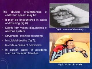 Rigor mortis ppt | PPT