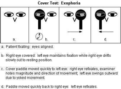 Strabismus Testing Techniques