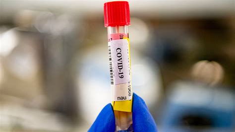 Blood collection organization to begin testing all donations for COVID-19 antibodies