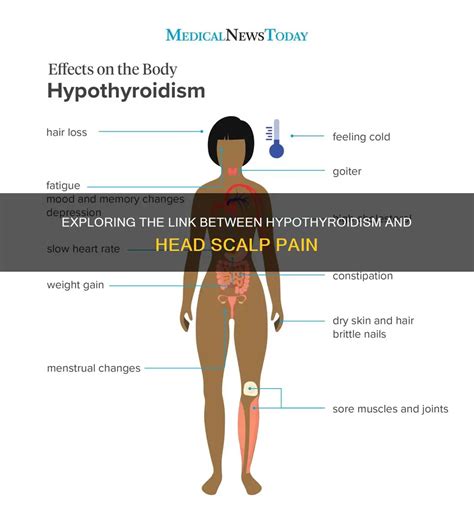 Exploring The Link Between Hypothyroidism And Head Scalp Pain | ShunHair