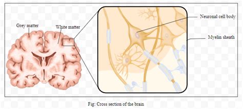 What do grey and white matter in the brain represent?