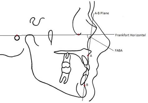 Table 1 from An Evaluation of the Constructed Frankfort Mandibular ...