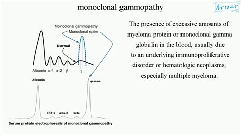 monoclonal gammopathy - YouTube