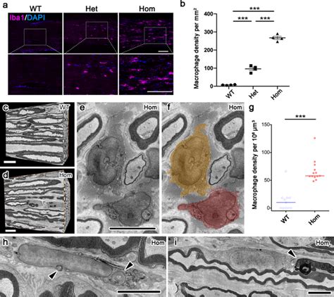 Upregulation of large myelin protein zero leads to Charcot–Marie–Tooth ...