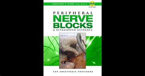 Peripheral Nerve Blocks and Ultrasound Guidance for Anesthesia ...