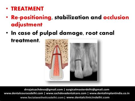 Tooth Injuries| Tooth Trauma| Treatment of Tooth Trauma