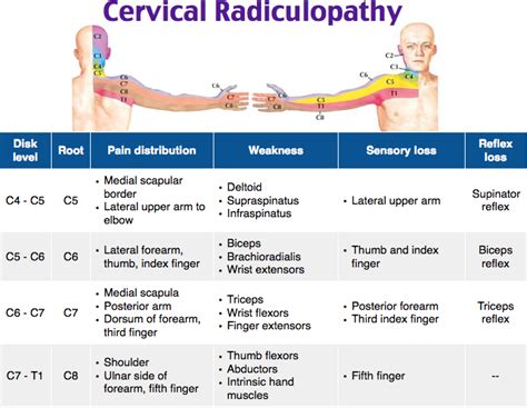 Cervical Radiculopathy C6