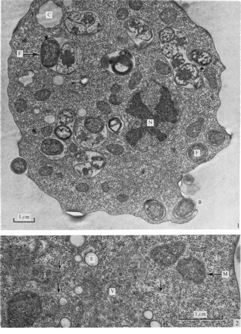 Dictyostelium Under Microscope