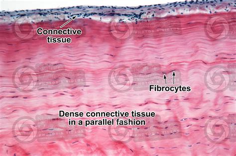 Mammal. Tendon. Longitudinal section. 125X - Tendons and ligaments ...