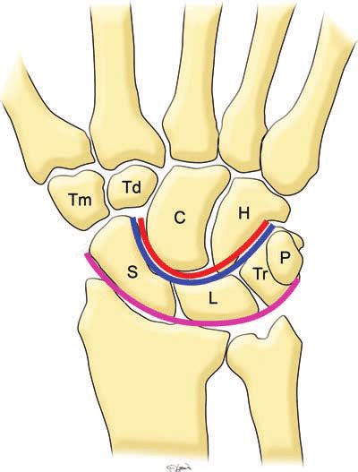 Normal anatomy of the carpal bones. Diagram of the wrist (frontal view)... | Download Scientific ...