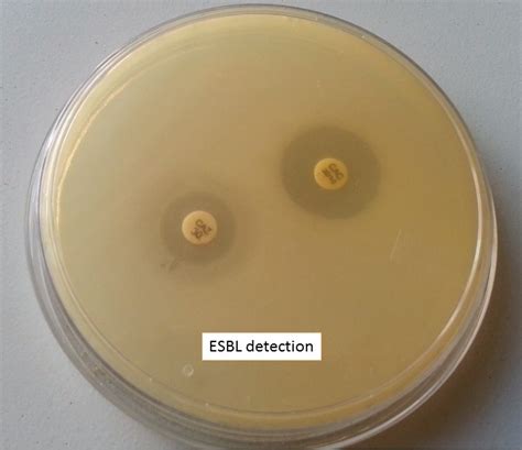 ESBL: Introduction, detection methods and Treatment option