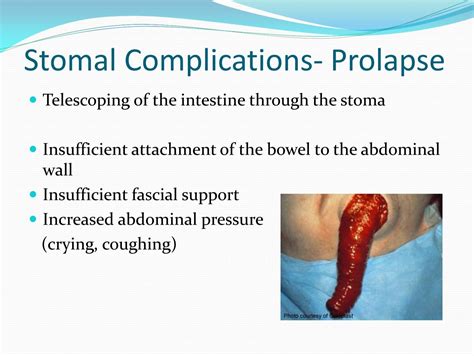 Stomal Complications Muco