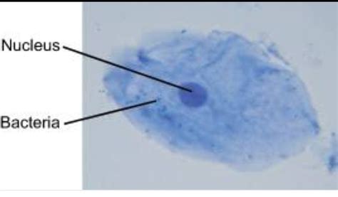 draw the human cheek cell with correct labelling - Brainly.in