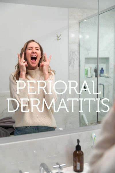 Healing Perioral Dermatitis Naturally: 11 Treatment Tips | Feed Me Phoebe