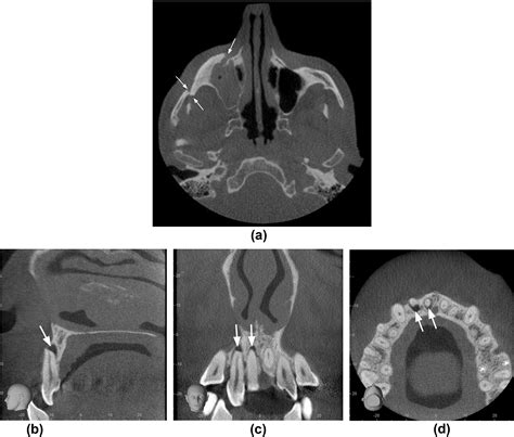 Cone Beam Ct Radiology Ppt - The Best Picture Of Beam