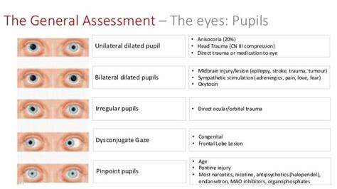 The Paramedic Neurological Assessment | Neurological assessment, Paramedic school, Medical ...