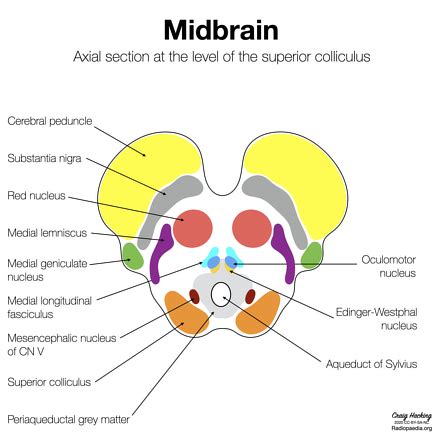 Midbrain | Radiology Reference Article | Radiopaedia.org