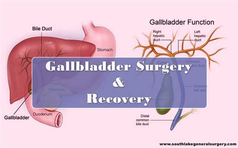 Gallbladder surgery and recovery time Archives - Southlake General Surgery