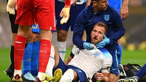 Harry Kane suffers horrific injury with blood pouring from mouth | Football News - Hindustan Times