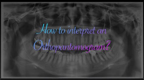 How to Interpret an OPG (Orthopantomogram) ? - YouTube