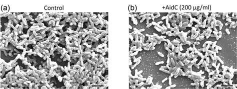 SEM images of Pseudomonas aeruginosa biofilms. (a) Biofilm is formed by... | Download Scientific ...