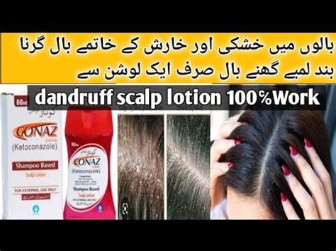 Conaz lotion Shampoo based | Anti Dandruff Medicated Shampoo | Honest ...