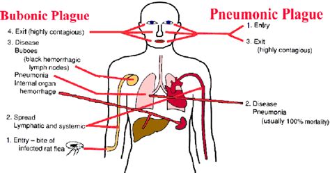 Types of plague and their transmission/risks | Download Scientific Diagram