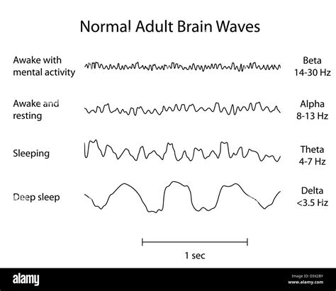 Normal Brain Waves EEG Stock Photo - Alamy