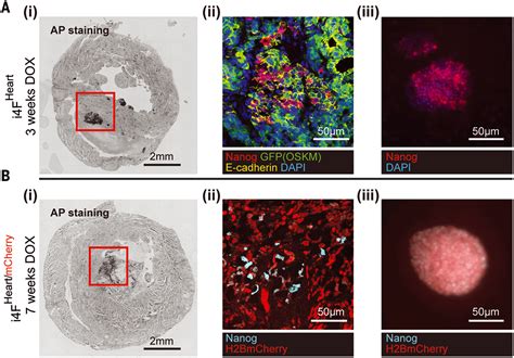 Reversible reprogramming of cardiomyocytes to a fetal state drives heart regeneration in mice ...