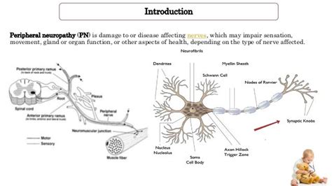 Giant axonal neuropathy