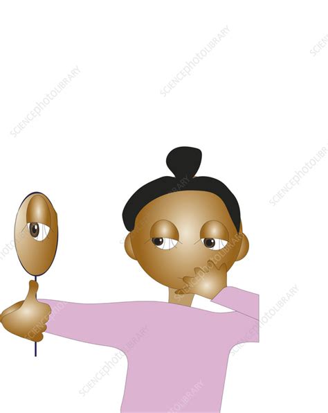 Woman with body dysmorphia, illustration - Stock Image - F037/6073 ...