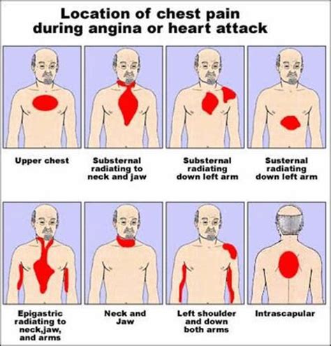 Prani: Symptoms and signs of heart attack